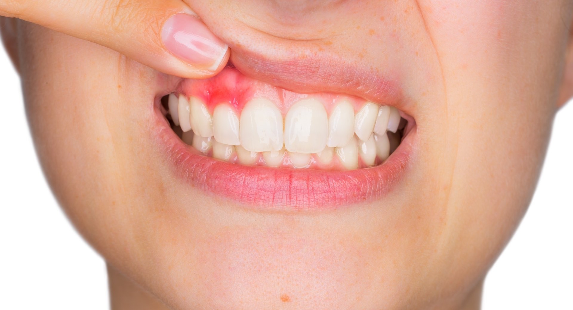 What Does Your Teeth and Gums Tell About Your Body? 